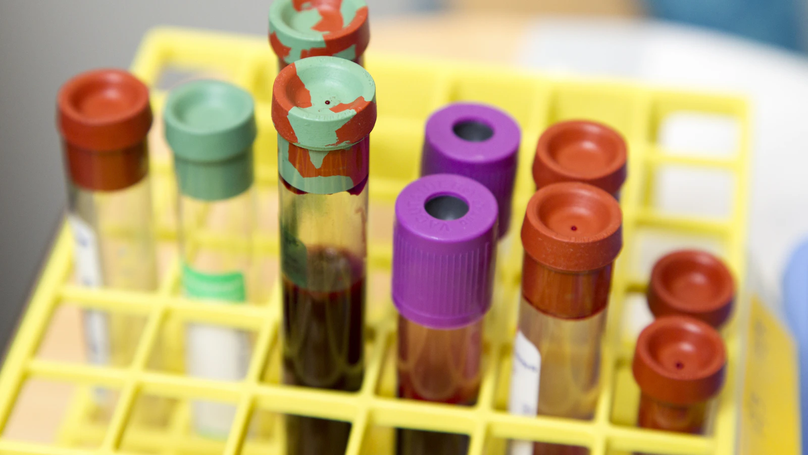 Blood collection tubes ready for analysis in a laboratory.