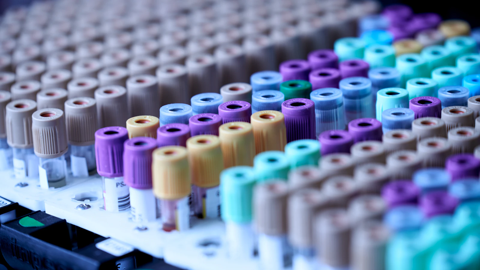 Rekken met gekleurde bloedbuisjes klaar voor analyse in een laboratorium.