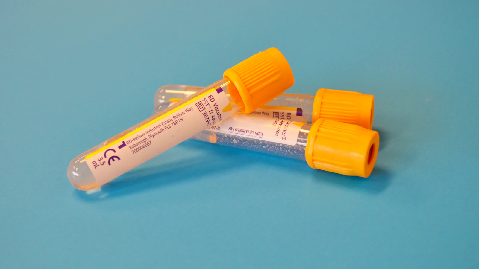 Buisje voor bloedonderzoek in het laboratorium.