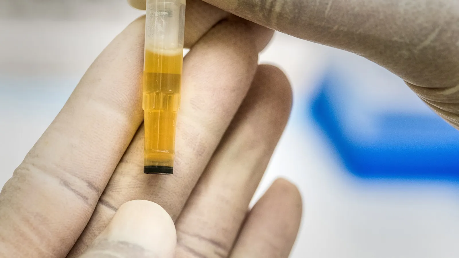 Een hand met handschoen houdt een buisje met serum vast in een laboratorium.
