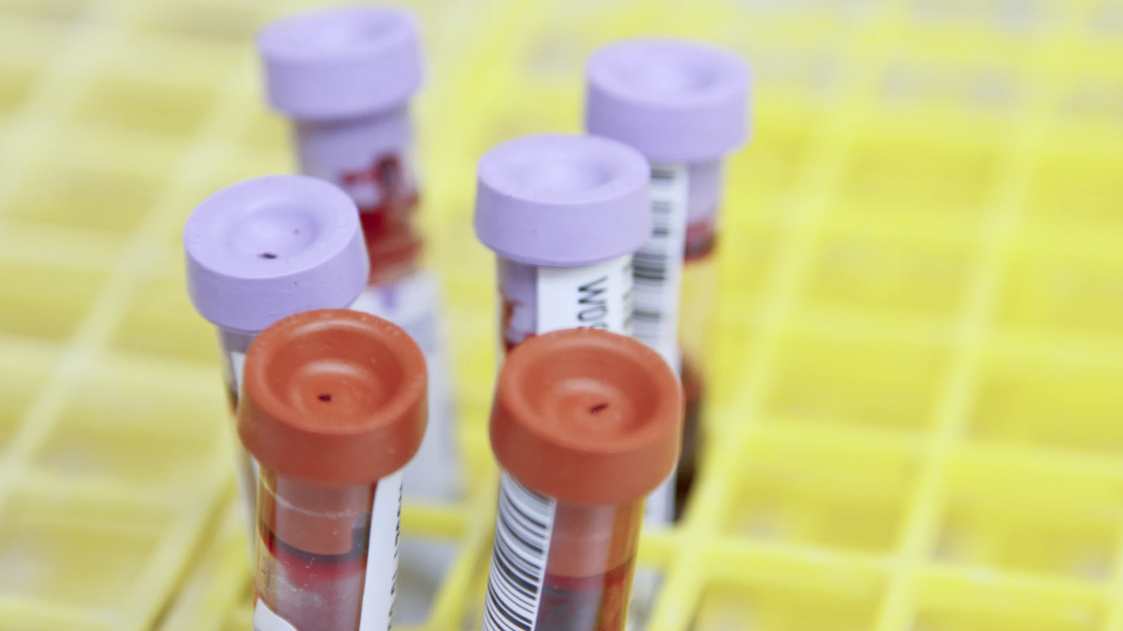 Blood collection tubes ready for analysis in a laboratory.
