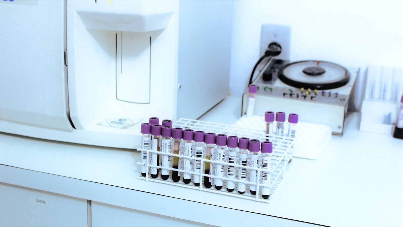 Rek met bloedbuisjes naast een hematologie-analyseapparaat in een laboratorium.