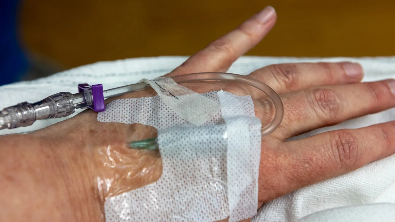 Infuusnaald met pleister vastgezet op de hand van een volwassene.